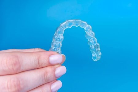 Clear Aligners UK