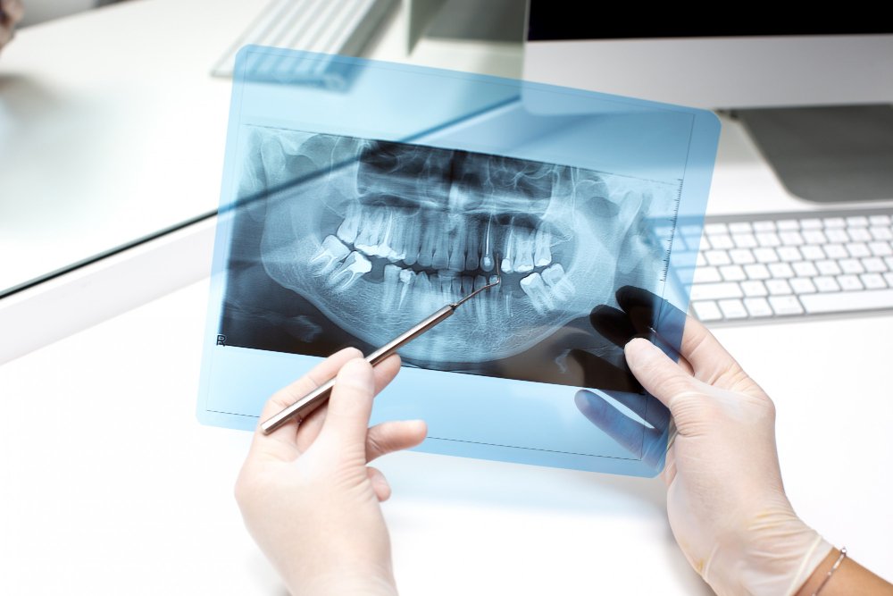 Is Teeth Straightening Just a Cosmetic Choice?