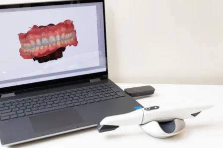 Is Digital Treatment Planning Accurate for Aligners? | AccuAligners