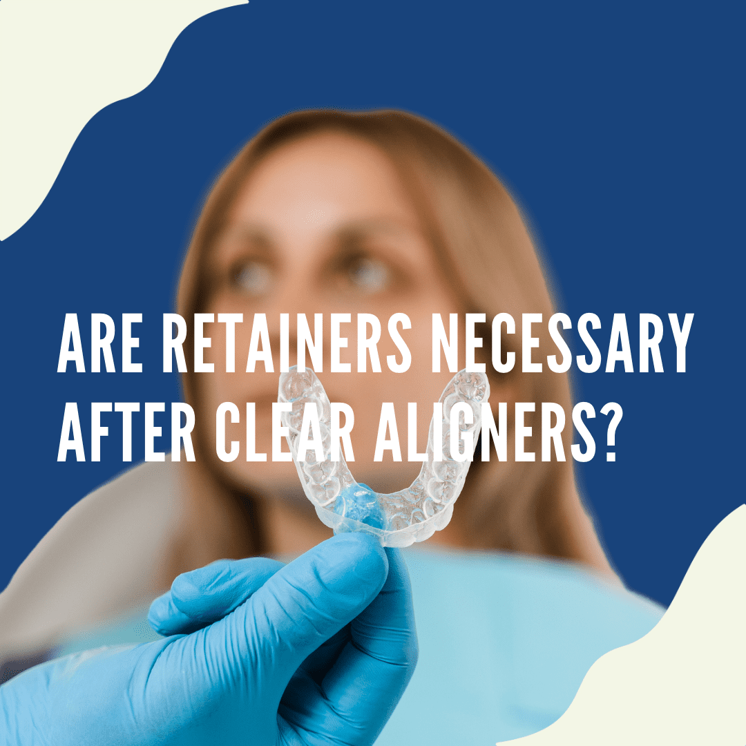 Are Retainers necessary after Clear Aligners?